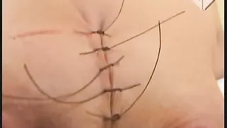 Good Chained Nipples And Bleeding Boobs In The Surgery