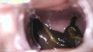 Playful Hottie With Accurate Pussy Is Getting Some Leeches Inside