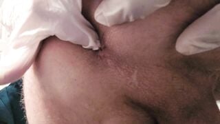 Nurse Nerdy Obtaining A Semen Sample